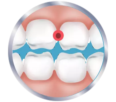 Pinpointing tooth pain icon
