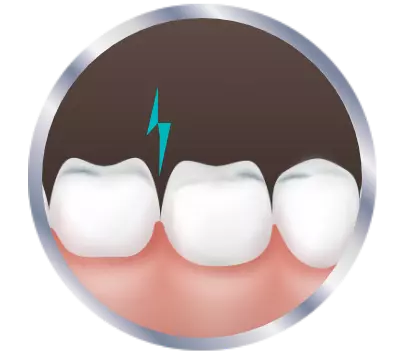Experiencing tooth sensitivity icon