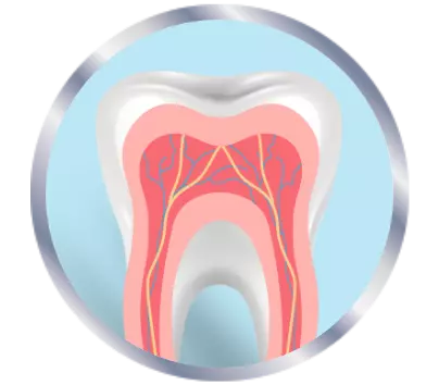 Inflammed nerves in teeth