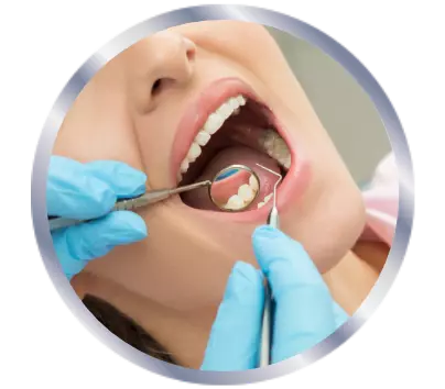 Woman opening her mouth for the dentist